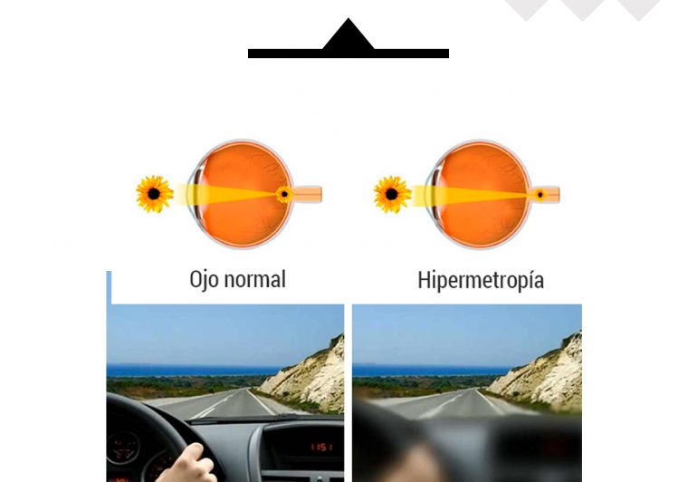 Hospital Privado De Ojos